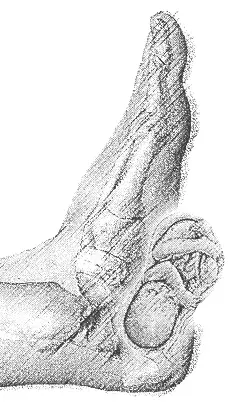 Maternity Reflexology by Beverly Parmer Reflexology